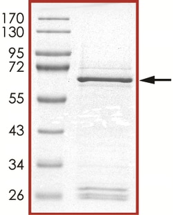 Sino Biological&nbsp;Recombinant Human Tribbles 3/TRIB3 Protein (Full Length, GST Tag)