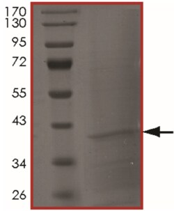 Sino Biological&nbsp;Recombinant Human TPM3 Protein (Full Length, His Tag)