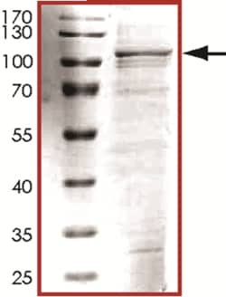 Sino Biological&nbsp;Recombinant Human TPX2 Protein (Full Length, His Tag)