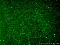 TAU Rabbit, anti-Human, CoraLite Plus 488, Polyclonal, Proteintech Quantity: