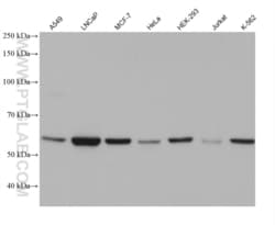 TBC1D24 Mouse, anti-Human, Clone: 1C7C4, Proteintech Quantity: 20 &mu;L:Antibodies