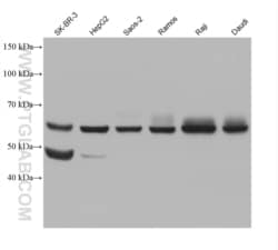 TFEB Mouse, anti-Human, Clone: 1C2D9, Proteintech Quantity: 150 &mu;L:Antibodies