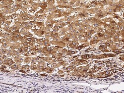 Sino Biological Tie1 Antibody, Mouse MAb 100µL, Quantity: Each of 1