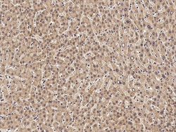 Sino Biological Anti-DcR2/TRAIL R4 Antibody, Mouse Monoclonal, Quantity: