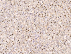 Sino Biological Anti-DcR2/TRAIL R4 Antibody, Rabbit Polyclonal, Quantity:
