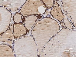 Sino Biological Thyroid peroxidase / TPO Antibody, Mouse MAb 100µL, Quantity: