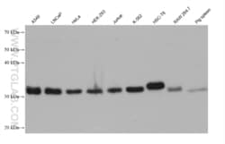 TRADD Mouse, anti-Human, Clone: 1C3H3, Proteintech Quantity: 150 &mu;L:Antibodies