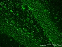 TRPM2 Rabbit, anti-Human, Polyclonal, Proteintech:Antibodies:Primary Antibodies
