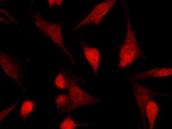 Sino Biological TSC22D1 Antibody, Rabbit MAb 100µL, Quantity: Each of 1