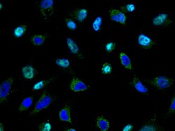Sino Biological Anti-TSG101 Antibody, Rabbit Polyclonal, Quantity: Each