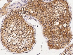 Sino Biological Anti-TRAX/TSNAX Antibody, Rabbit Polyclonal, Quantity: