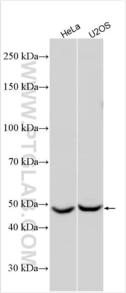 TTYH3 Rabbit, anti-Human, Polyclonal, Proteintech Quantity: 150 &mu;L:Antibodies
