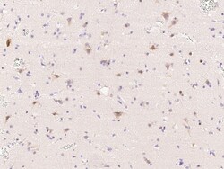 Sino Biological Anti-Tubby Antibody, Rabbit Polyclonal, Quantity: Each