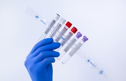 ITL BioMedical TiMO Tube Manager Organizer Clear | Buy Online | ITL BioMedical | Fisher Scientific