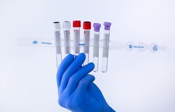 ITL BioMedical TiMO Tube Manager Organizer Clear | Buy Online | ITL BioMedical | Fisher Scientific