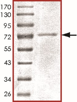 Sino Biological&nbsp;Recombinant Human UBA3/UBE1C Protein (Full Length, GST Tag)