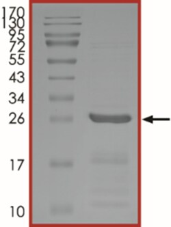Sino Biological&nbsp;Recombinant Human UBE2E3/UBCH9 Protein (Full Length, His Tag), Active