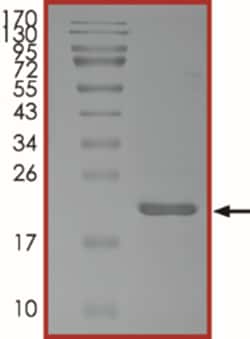 Sino Biological&nbsp;Recombinant Human UBE2G1 Protein (Full Length, His Tag), Active