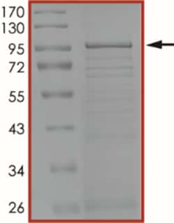 Sino Biological&nbsp;Recombinant Human USP5 Protein (Full Length, His Tag), Active