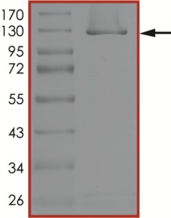 Sino Biological&nbsp;Recombinant Human USP10 Protein (GST Tag), Active