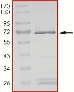 Sino Biological&nbsp;Recombinant Human Usp12 Protein (Full Length, GST Tag), Active