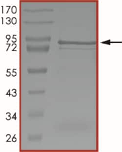 Sino Biological&nbsp;Recombinant Human USP25 Protein (GST Tag)