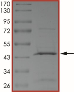 Sino Biological&nbsp;Recombinant Human USP46 Protein (Full Length, His Tag)