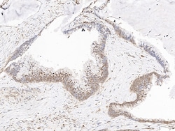 Sino Biological Rad6 / UBE2A Antibody, Rabbit PAb, Antigen Affinity Purified