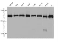 UBR2 Mouse, anti-Human, Clone: 1D5H2, Proteintech Quantity: 20 &mu;L:Antibodies