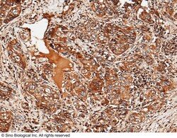 Sino Biological ULBP2 / N2DL-2 Antibody, Rabbit MAb 100uL, Quantity: Each