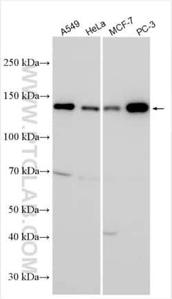 USP40 Rabbit, anti-Human, Polyclonal, Proteintech Quantity: 150 &mu;L:Antibodies