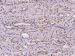 Sino Biological USP8 Antibody, Rabbit PAb, Antigen Affinity Purified 100µL,