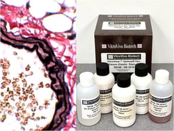 VITRO VIVO BIOTECH LLC&nbsp;VitroView&trade; Verhoeff Van Gieson Elastin Stain Kit
