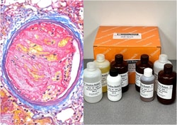 VITRO VIVO BIOTECH LLC VitroView™ Martius Scarlet Blue (MSB) Stain Kit,