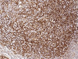 Sino Biological VCAM1/VCAM-1/CD106 Antibody, Rabbit PAb, Antigen Affinity