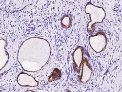 Sino Biological Anti-Vinculin Antibody, Rabbit Polyclonal, Quantity: Each