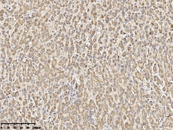Sino Biological Porin / VDAC1 Antibody, Rabbit PAb, Antigen Affinity Purified