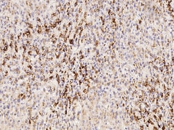 Sino Biological VEGF/VEGFA Antibody, Mouse MAb 100uL, Quantity: Each of