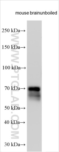 VGLUT2 Rabbit, anti-Human, Polyclonal, Proteintech