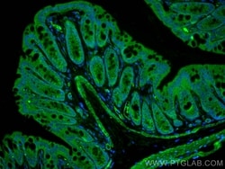 VIP Rabbit, anti-Human, CoraLite Plus 488, Polyclonal, Proteintech Quantity: