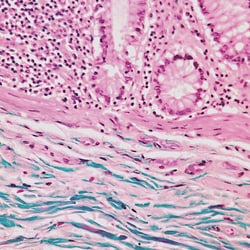 Polysciences, Inc. Gomori's Trichrome Stain Kit, 1Kit, Quantity: Each of