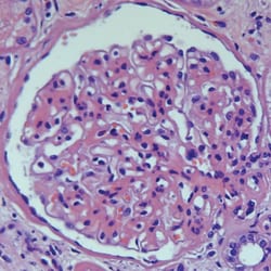 Polysciences, Inc. Gill's Hematoxylin no.3, triple strength for Histology,500ml,Qty-1,