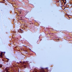 Polysciences, Inc. Von Kossa Method for Calcium Kit, Quantity: Each of