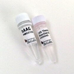 New England Biolabs, Inc.&nbsp;Human Alkyladenine Glycosylase (hAAG) – 500 units