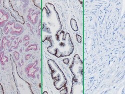 Newcomer Supply&nbsp;CK5/14 + p63 + P504S, Multi-Tissue Control Slides, 98/set