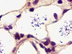 Newcomer Supply&nbsp;Gram Positive & Gram Negative Bacteria, Artificial Control Slides, 10/set