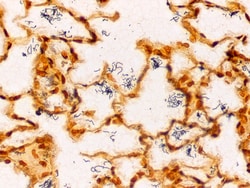 Newcomer Supply Spirochete, Artificial Control Slides, 98/set