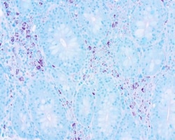 Newcomer Supply AFB, Ziehl-Neelsen Stain Kit, 250 ml kit, Quantity: Each