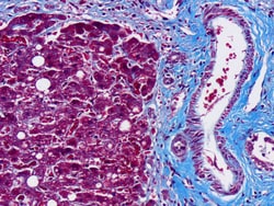 Newcomer Supply Trichrome, Gomori One-Step, Aniline Blue Stain Kit, 500