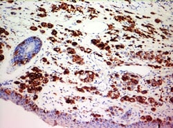 Biogenex Laboratories Melanoma : HMB45 : 6mL, Quantity: Each of 1